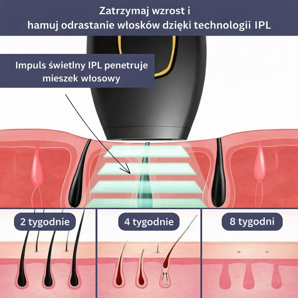 Depilator IPL domowy – 5 poziomów mocy, urządzenie kosmetyczne